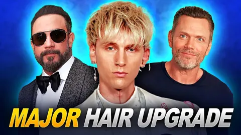 Celebrity Hair Transplant Transformations and Their Impact on Public Image