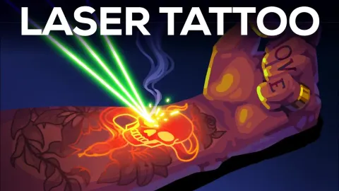 How Laser Tattoo Removal Works and Why It's Painful